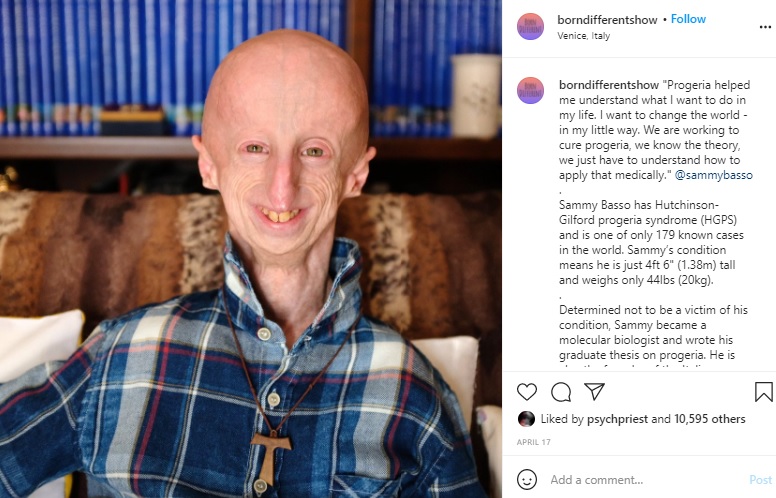 早老症であるプロジェリアを患うサミーさん（画像は『Born Different　2021年4月17日付Instagram「Progeria helped me understand what I want to do in my life.」』のスクリーンショット）