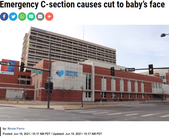事故があったデンバー市内の病院（画像は『KRON4　2021年6月19日付「Emergency C-section causes cut to baby’s face」』のスクリーンショット）
