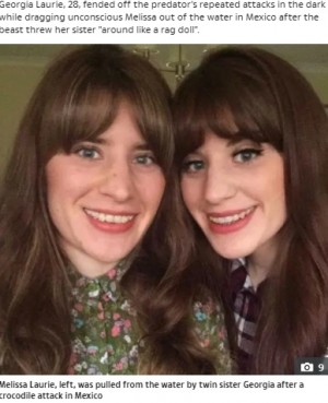 【海外発！Breaking News】ワニに襲われた女性、双子の姉妹が顔面パンチで救出「アドレナリンが出た」（メキシコ）