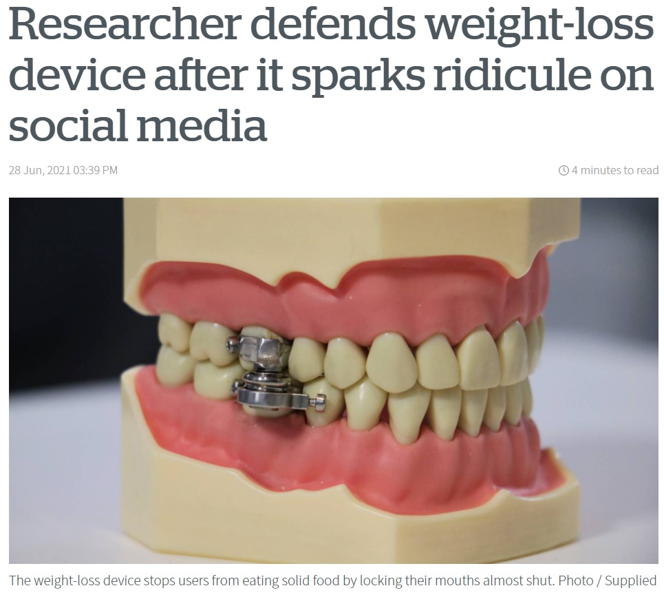 奥歯に装着して口を2ミリしか開かないように制限するデバイス（画像は『NZ Herald　2021年6月28日付「DentalSlim Diet Control: Researcher defends weight-loss device after it sparks ridicule on social media」（Photo / Supplied）』のスクリーンショット）