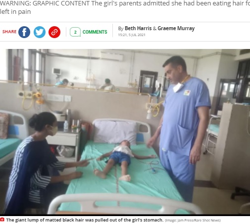 病院で治療を受ける5歳女児（画像は『Mirror　2021年7月5日付「Doctors remove huge hairball from five-year-old girl’s stomach - and it weighs over 3lbs」（Image: Jam Press/Rare Shot News）』のスクリーンショット）