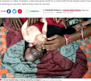 頭が3つある赤ちゃんが誕生（画像は『The Daily Star　2021年7月13日付「Three-headed baby hailed as incarnation of God after seemingly ‘normal’ pregnancy」（Image: Jam Press/Rare Shot News）』のスクリーンショット）