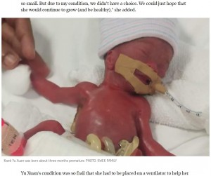 体重わずか212グラムで誕生したユーシャンちゃん（画像は『The Straits Times　2021年8月7日付「Discharged after 13 months at NUH, world’s tiniest baby is now a healthy 6.3kg」（PHOTO: KWEK FAMILY）』のスクリーンショット）