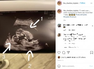 妊娠13週の超音波検査の写真（画像は『Gina Dewdney- Triplet Mama　2021年3月15日付Instagram「13 week scan....」』のスクリーンショット）