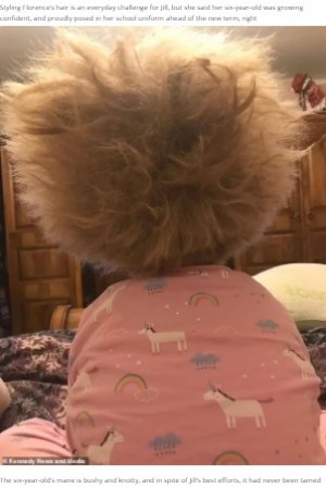 【海外発！Breaking News】「櫛でとかせない頭髪症候群」の明るい6歳女児に「ゴージャス」の声（英）
