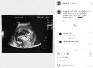 赤ちゃんのエコー写真まで公開したリル・ナズ・X（画像は『MONTERO　2021年9月2日付Instagram「SURPRISE!」』のスクリーンショット）