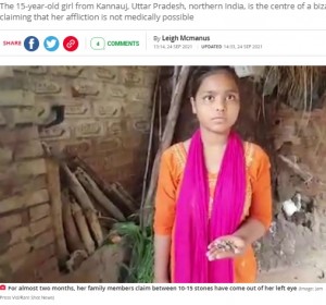 【海外発！Breaking News】左目から石の涙を流す15歳少女、医師は「説明がつかない」（印）＜動画あり＞