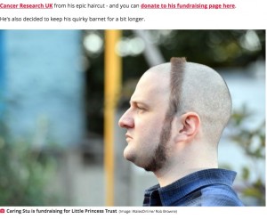 寄付者からのリクエストに応えた結果（画像は『The Mirror　2021年10月6日付「Man shaves off hair but leaves ring around head - and gets mistaken for hipster」（Image: WalesOnline/ Rob Browne）』のスクリーンショット）