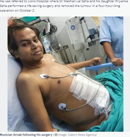 手術を終えたアルナブさん（画像は『The Mirror　2021年10月13日付「Gigantic 22lbs tumour removed from patient’s stomach in four-hour operation」（Image: Caters News Agency）』のスクリーンショット）
