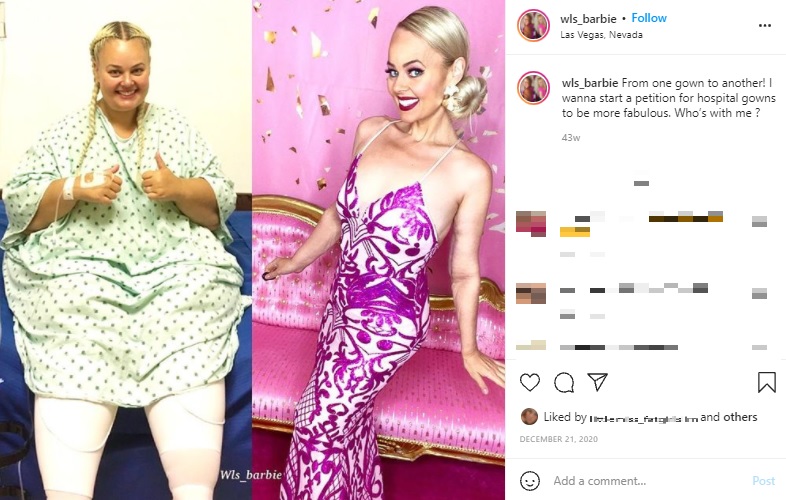 手術前と90キロ以上減量した現在の女性（画像は『Kayla Lavende　2020年12月21日付Instagram「From one gown to another!」』のスクリーンショット）