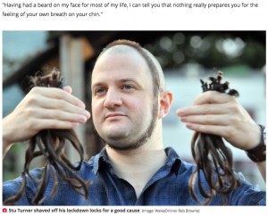 サークル・ヘアにもだいぶ慣れたとのこと（画像は『The Mirror　2021年10月6日付「Man shaves off hair but leaves ring around head - and gets mistaken for hipster」（Image: WalesOnline/ Rob Browne）』のスクリーンショット）