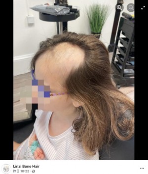 【海外発！Breaking News】電動ミキサーに髪の毛が絡まった5歳女児、前頭部の髪がごっそり引き抜かれる（スコットランド）
