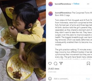 祖母が作った料理を食べる2人（画像は『Born Different　2021年9月28日付Instagram「The Conjoined Twins Who Were Born With 3 Legs」』のスクリーンショット）
