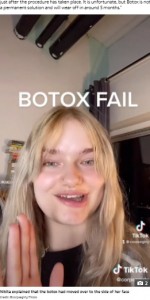 ボトックスがトラウマに（画像は『The Sun　2021年10月19日付「FACE FACTS I got Botox to fix my chin dimples and now I talk with a lisp and my whole face is crooked」（Credit: ＠corpsegirly/Tiktok）』のスクリーンショット）