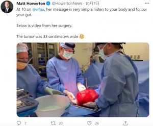 7.7キロの腫瘍を両手で抱えるようにして持ち上げた医師（画像は『Matt Howerton　2021年10月7日付Twitter「At 10 on ＠wfaa, her message is very simple: listen to your body and follow your gut.」』のスクリーンショット）
