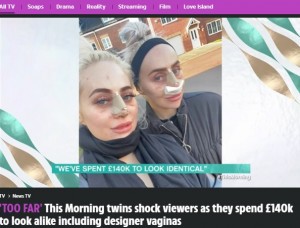 同じ日に鼻の整形をした双子（画像は『The Sun　2021年10月4日付「‘TOO FAR’ This Morning twins shock viewers as they spend ￡140k to look alike including designer vaginas」（Credit: itv）』のスクリーンショット）