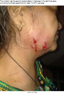 ヒョウに襲われてできた傷（画像は『LADbible　2021年9月30日付「55 Year Old Indian Woman Fights Off Leopard With Walking Stick」（Credit: Jam Press）』のスクリーンショット）