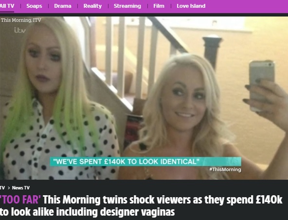 骨格の違いがはっきりわかる整形前のデイジーさん（右）とドリーさん（画像は『The Sun　2021年10月4日付「‘TOO FAR’ This Morning twins shock viewers as they spend ￡140k to look alike including designer vaginas」（Credit: itv）』のスクリーンショット）