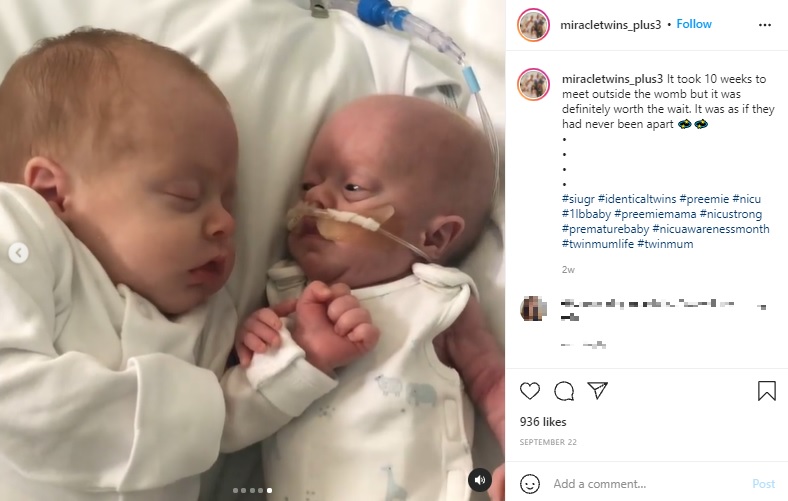誕生後、初めて対面したオーティス君（左）とチェスター君（画像は『Kelly Graves　2021年9月22日付Instagram「It took 10 weeks to meet outside the womb 」』のスクリーンショット）