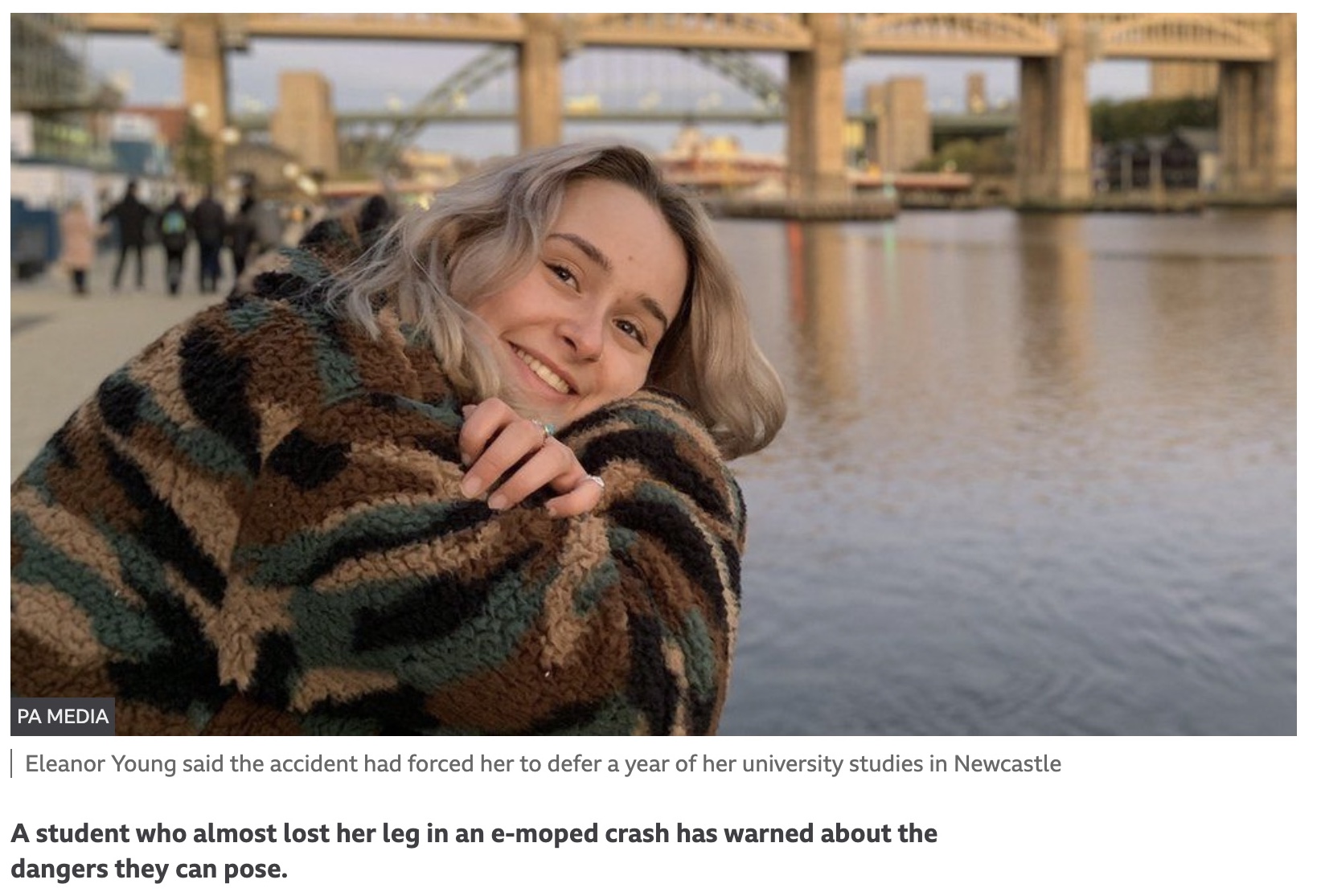 旅先で電動スクーターに乗り事故に遭った女性（画像は『BBC News　2021年11月26日付「E-moped crash warning from student who nearly lost leg」（PA MEDIA）』のスクリーンショット）