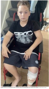 しばらくは車椅子での生活に（画像は『The Daily Star　2021年11月7日付「Boy, 10, in wheelchair after dog attack left him ‘looking like shark bite victim’」（Image: Natasha Dundas）』のスクリーンショット）