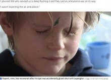 【海外発！Breaking News】父親が目薬と間違えて瞬間接着剤を使用　9歳男児、4日間目を開けられず（英）