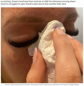 施術中に痛みがあったというゾーイさん（画像は『Tyla　2021年11月22日付「Woman Blinded After Making Simple False Eyelash Mistake」（Credit: Triangle News）』のスクリーンショット）