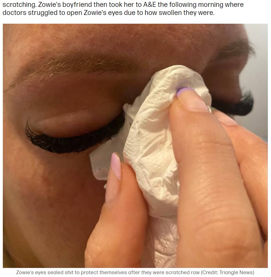 施術中に痛みがあったというゾーイさん（画像は『Tyla　2021年11月22日付「Woman Blinded After Making Simple False Eyelash Mistake」（Credit: Triangle News）』のスクリーンショット）