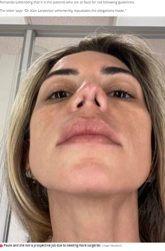 手術後に嗅覚を失ったというポーラさん（画像は『The Daily Star　2021年11月5日付「Plastic surgeon who ‘mutilated’ 30 patients in botched nose jobs claims it’s their fault」（Image: Newsflash）』のスクリーンショット）