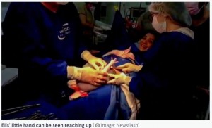 ブラジルのケースでは赤ちゃんが腕を伸ばして膜の中から出てきた（画像は『The Mirror　2021年12月14日付「Magical moment baby born still inside amniotic sac breaks free by punching her way out」（Image: Newsflash）』のスクリーンショット）