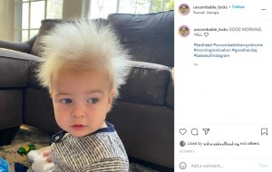 【海外発！Breaking News】逆立つ髪を持つ「櫛でとかせない頭髪症候群」の1歳男児、母親は「人と違うことはユニークで誇り」（米）