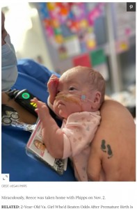 超低出生体重児として誕生した赤ちゃん（画像は『People.com　2021年12月27日付「Woman with Double Uterus Gives Birth at 22 Weeks: Baby ‘Is a True Miracle’」（CREDIT: MEGAN PHIPPS）』のスクリーンショット）
