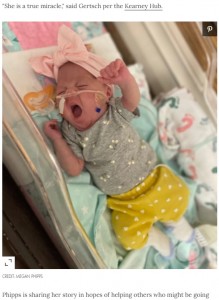 奇跡的に合併症もなかったリースちゃん（画像は『People.com　2021年12月27日付「Woman with Double Uterus Gives Birth at 22 Weeks: Baby ‘Is a True Miracle’」（CREDIT: MEGAN PHIPPS）』のスクリーンショット）