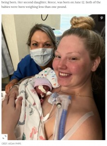 「生存確率は1％」と言われるも出産したメーガンさん（画像は『People.com　2021年12月27日付「Woman with Double Uterus Gives Birth at 22 Weeks: Baby ‘Is a True Miracle’」（CREDIT: MEGAN PHIPPS）』のスクリーンショット）