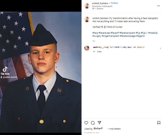 米陸軍で働いていた事故前のミッチさん（画像は『Mitch Hunter　2021年12月28日付Instagram「My transformation after having a face transplant.」』のスクリーンショット）