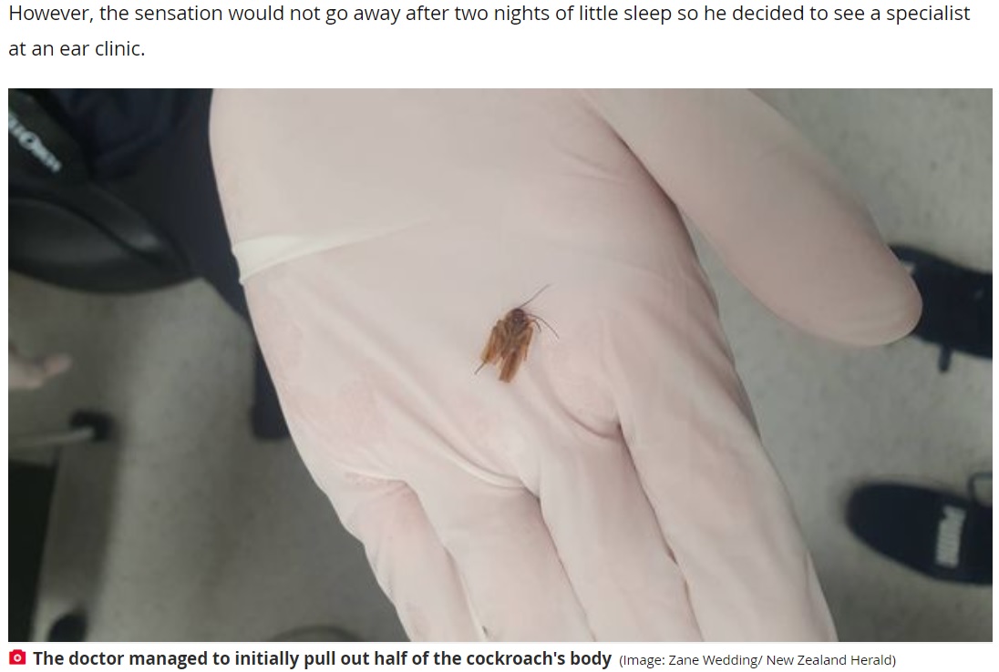 ゼインさんの耳の中から取り出された小さなゴキブリ（画像は『The Daily Star　2022年1月12日付「Man’s ‘blocked ear’ turns out to have massive cockroach hiding inside」（Image: Zane Wedding/ New Zealand Herald）』のスクリーンショット）