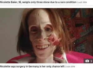 『GoFundMe』で手術代の寄付を募るニコレットさん（画像は『The Sun　2022年1月7日付「FIGHT FOR LIFE I weigh just 3 stone at 36 as rare condition is starving me to death」（Credit: BPM）』のスクリーンショット）