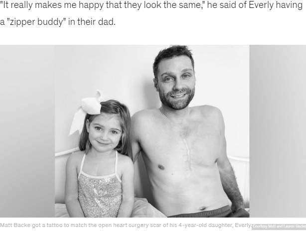 お揃いのジッパーのタトゥー（画像は『Good Morning America　2022年2月9日付「Dad gets tattoo on chest to match 4-year-old daughter's heart surgeries scar」（Courtesy Matt and Lauren Backe）』のスクリーンショット）