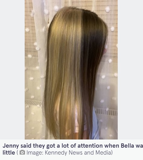 「染めているの？」とよく聞かれるというベラちゃん（画像は『The Mirror　2022年2月2日付「Schoolgirl, 11, has half blonde and half brown hair due to rare genetic birthmark」（Image: Kennedy News and Media）』のスクリーンショット）