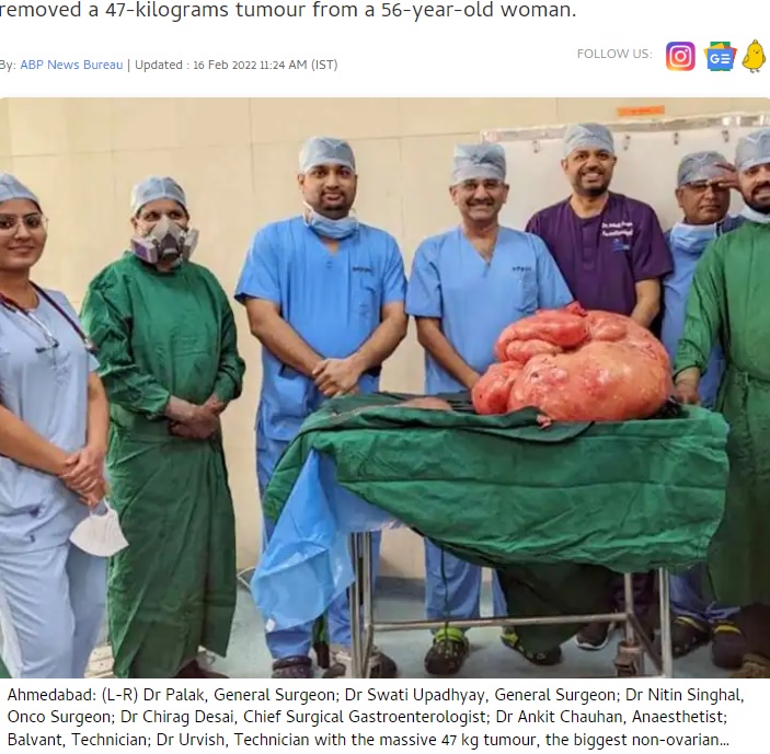 摘出された巨大な腫瘍（画像は『ABP LIVE　2022年2月16日付「Doctors Remove 47-Kg Tumour From Woman’s Abdomen, Biggest Non-Ovarian Tumour In Indian Records」』のスクリーンショット）