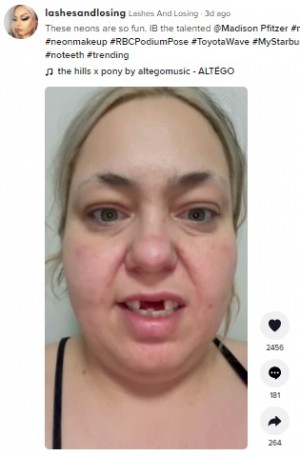 【海外発！Breaking News】前歯のない35歳女性、メイクと人工歯で「認識不可」にパワーアップ（カナダ）＜動画あり＞