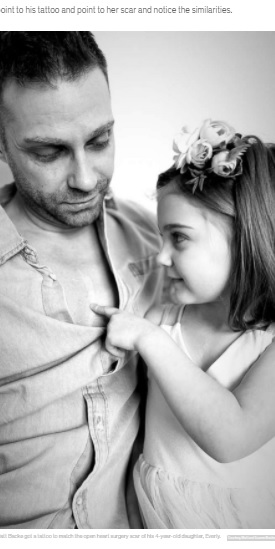 「ダディは私の真似をしたのよ！」と語る4歳の娘（画像は『Good Morning America　2022年2月9日付「Dad gets tattoo on chest to match 4-year-old daughter's heart surgeries scar」（Courtesy Matt and Lauren Backe）』のスクリーンショット）