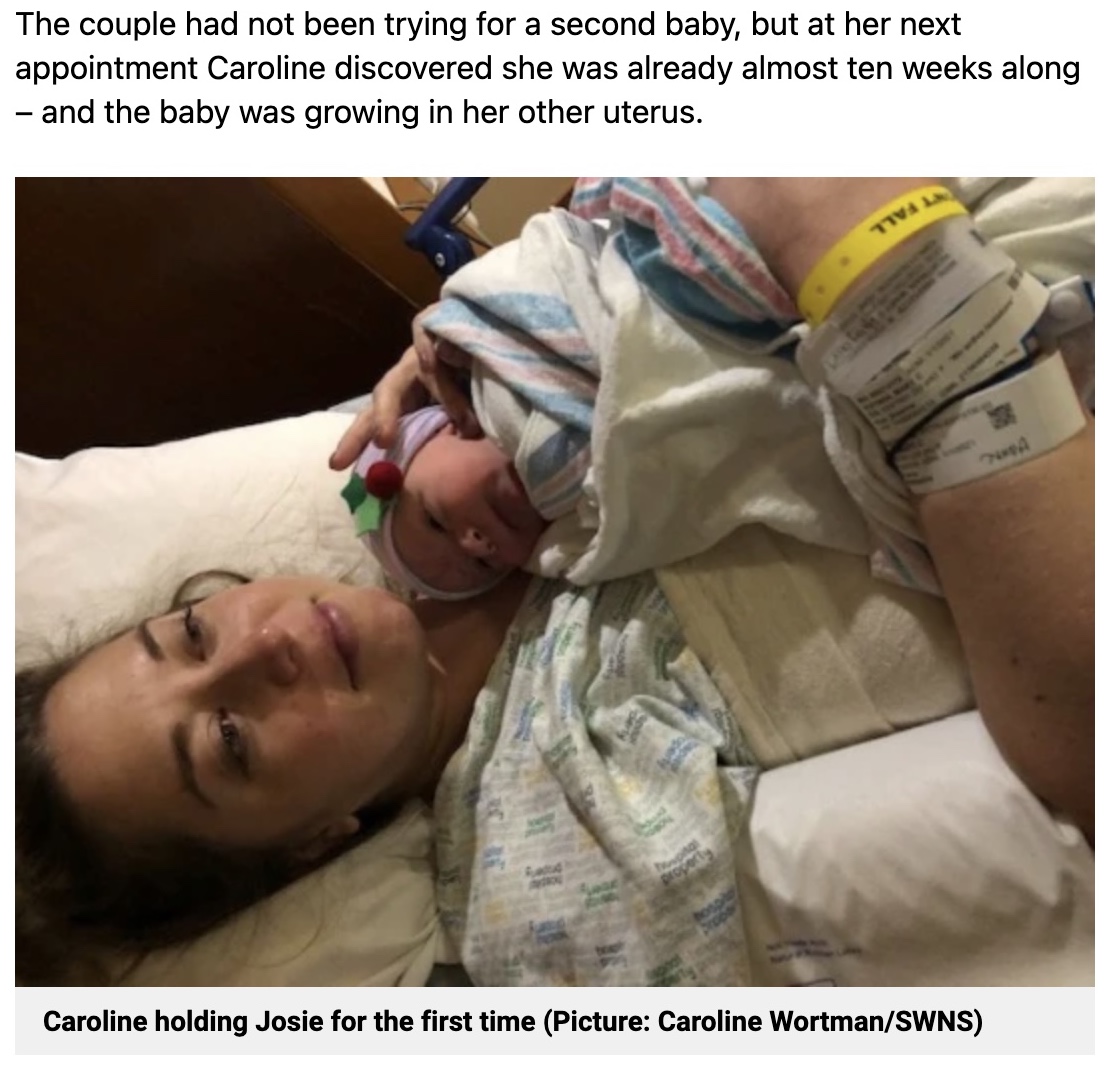 2つの子宮を持ち、1年間で2度出産した女性（画像は『Metro　2022年3月8日付「Mum gives birth to two babies in one year - from separate uteruses」（Picture: Caroline Wortman/SWNS）』のスクリーンショット）