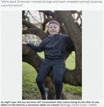 【海外発！Breaking News】毒ヘビに噛まれた8歳男児、母親は「手が大きく腫れて破裂しそうなほどだった」（英）