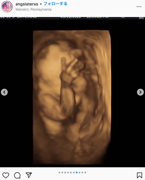裏ピースまで見せるお腹の赤ちゃん（画像は『A N G . S L A T E R　2022年3月11日付Instagram「We did a 3D/4D ultrasound today」』のスクリーンショット）