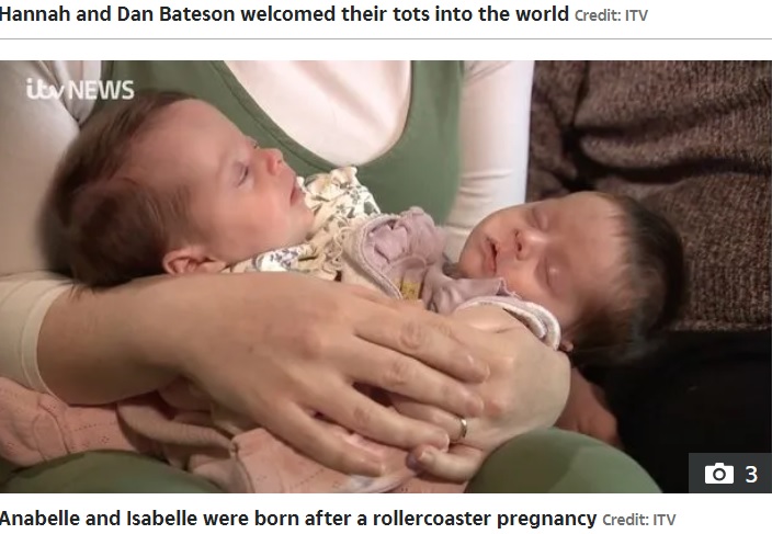 それぞれに心臓を持っていた2人（画像は『The Sun　2022年4月23日付「‘THEY’RE MIRACLES’ Brit couple welcome ‘miracle’ conjoined twins who ‘constantly hug each other’ after roller coaster pregnancy」（Credit: ITV）』のスクリーンショット）