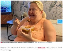 【海外発！Breaking News】「マクドナルドの前を素通りできなかった」暴飲暴食を続けていた女性、胃の切除手術で40キロ超の減量に成功（英）