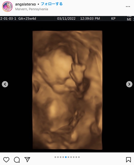 中指を突き立てるお腹の赤ちゃん（画像は『A N G . S L A T E R　2022年3月11日付Instagram「We did a 3D/4D ultrasound today」』のスクリーンショット）
