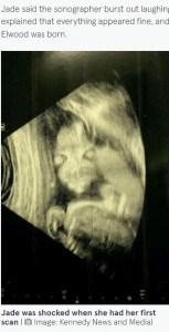 超音波検査で捉えられた赤ちゃんはまるで悪魔？（画像は『The Mirror　2022年4月8日付「Mum scared of unborn ‘demon child’ as baby looks like ‘Salad Fingers’ in scan」（Image: Kennedy News and Media）』のスクリーンショット）