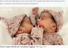 【海外発！Breaking News】胸部から結合した“奇跡”の双子、生後6週になり「ハグが大好き」（北アイルランド）